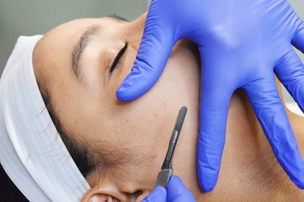 LUXE DERMAPLANING BRISTOL - GAIA SKIN DEEP