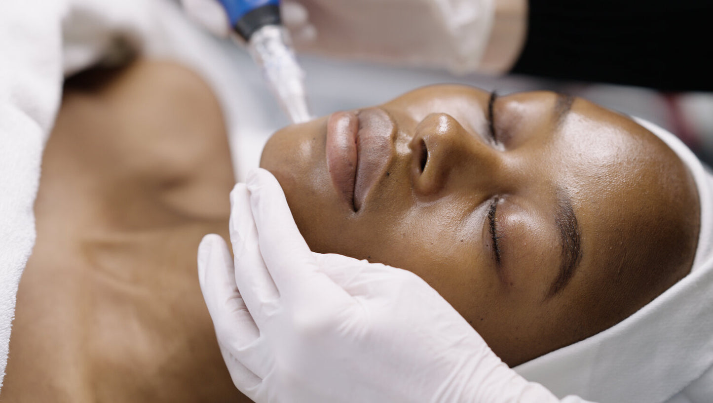 MICRONEEDLING FACIAL BRISTOL - GAIA SKIN DEEP